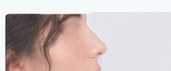 Illustrative nose profile image placeholder